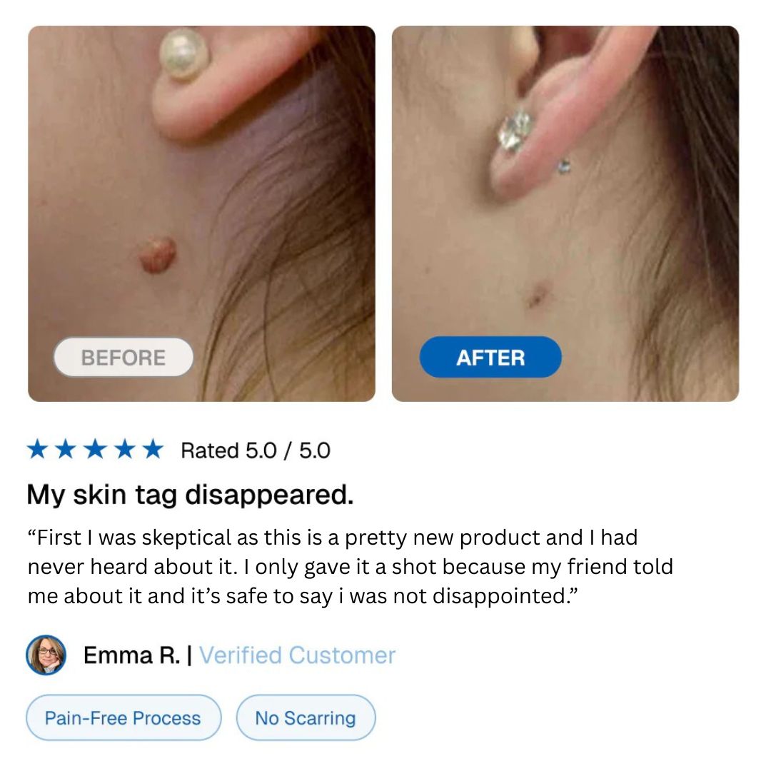 Luvera TagLift kit™