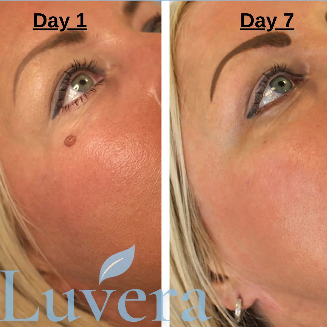 Luvera TagLift kit™