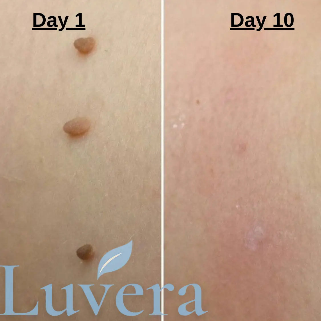 Luvera TagLift kit™