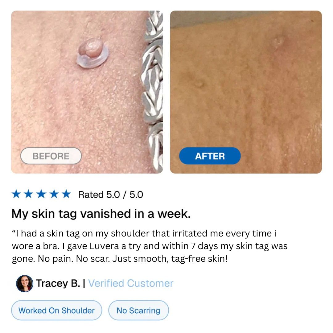 Luvera TagLift kit™