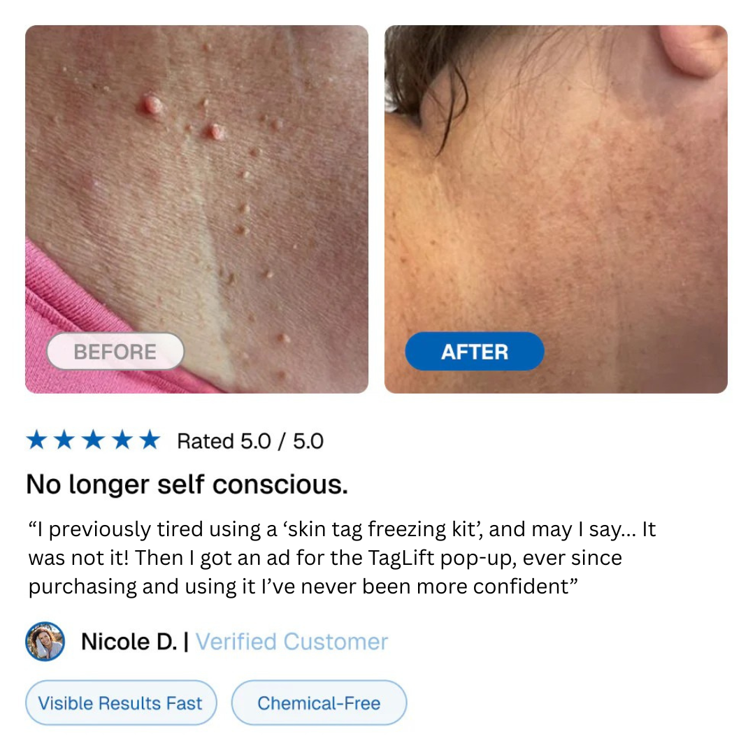 Luvera TagLift kit™